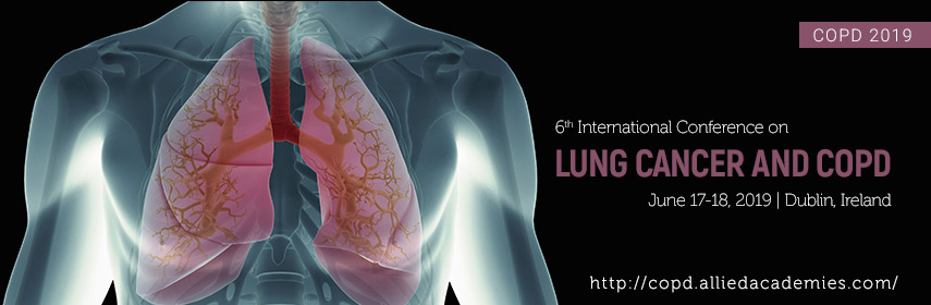 6th International Conference on Lung Cancer and COPD 